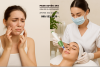 CÁCH TRỊ MỤN CHUẨN Y KHOA TẠI SPA BÌNH CHÁNH – GIẢI PHÁP SẠCH MỤN, KHÔNG TÁI PHÁT